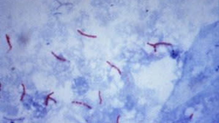 Vědci chtějí lépe poznat mykobakterie a rizika, která přinášejí